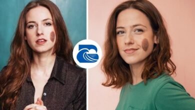 Chloe Radcliffe Birthmark